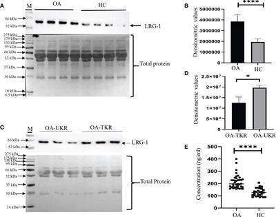 Upregulation of leucine-rich alpha-2 glycoprotein: A key regulator of inflammation and joint fibrosis in patients with severe knee osteoarthritis